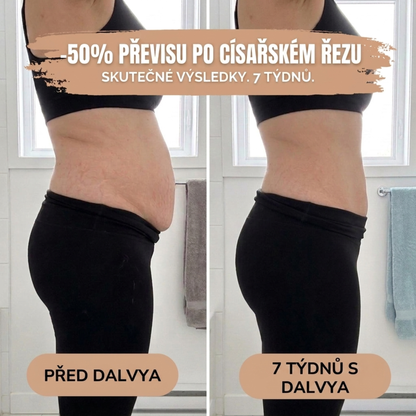 Poporodní kalhotky — 360° komprese